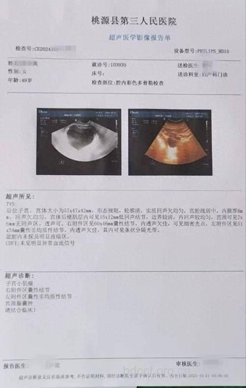 盆腔是否有肿块要做什么检查？