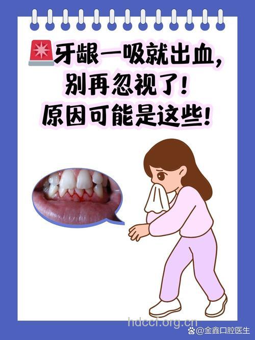 牙龈出血是不是代表有肝病