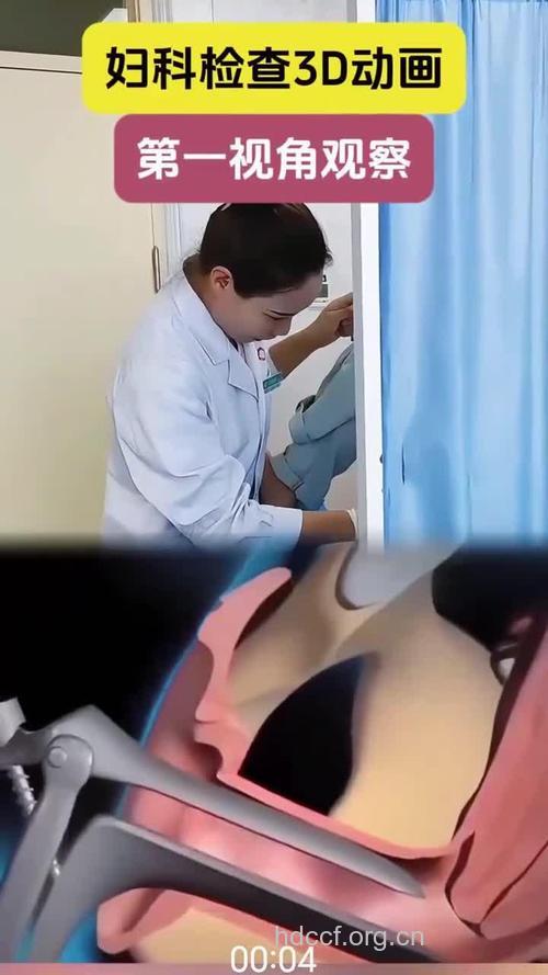 女性妇科体检时的尴尬事