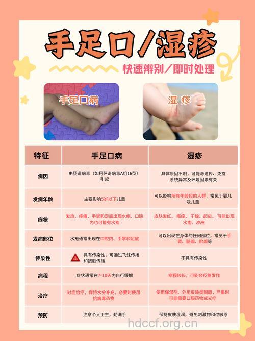 中医辨别手足口病:一摸二看