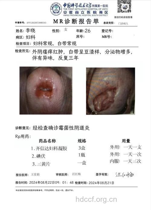 惊！七成女性查出妇科炎症