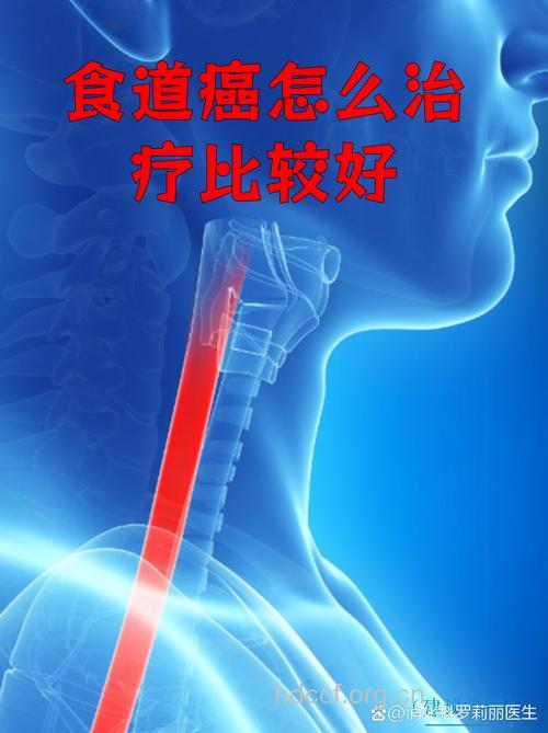 化学治疗食道癌效果好吗