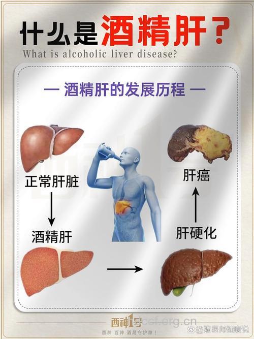 饮酒容易让我们患上肝病