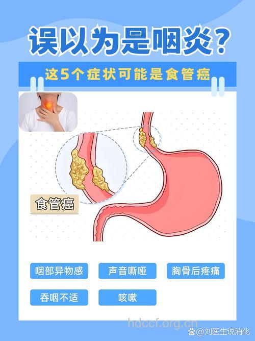 食道癌与食道狭窄症状有区别吗