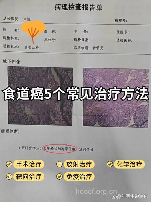 食道癌患者进食哽噎是怎么回事