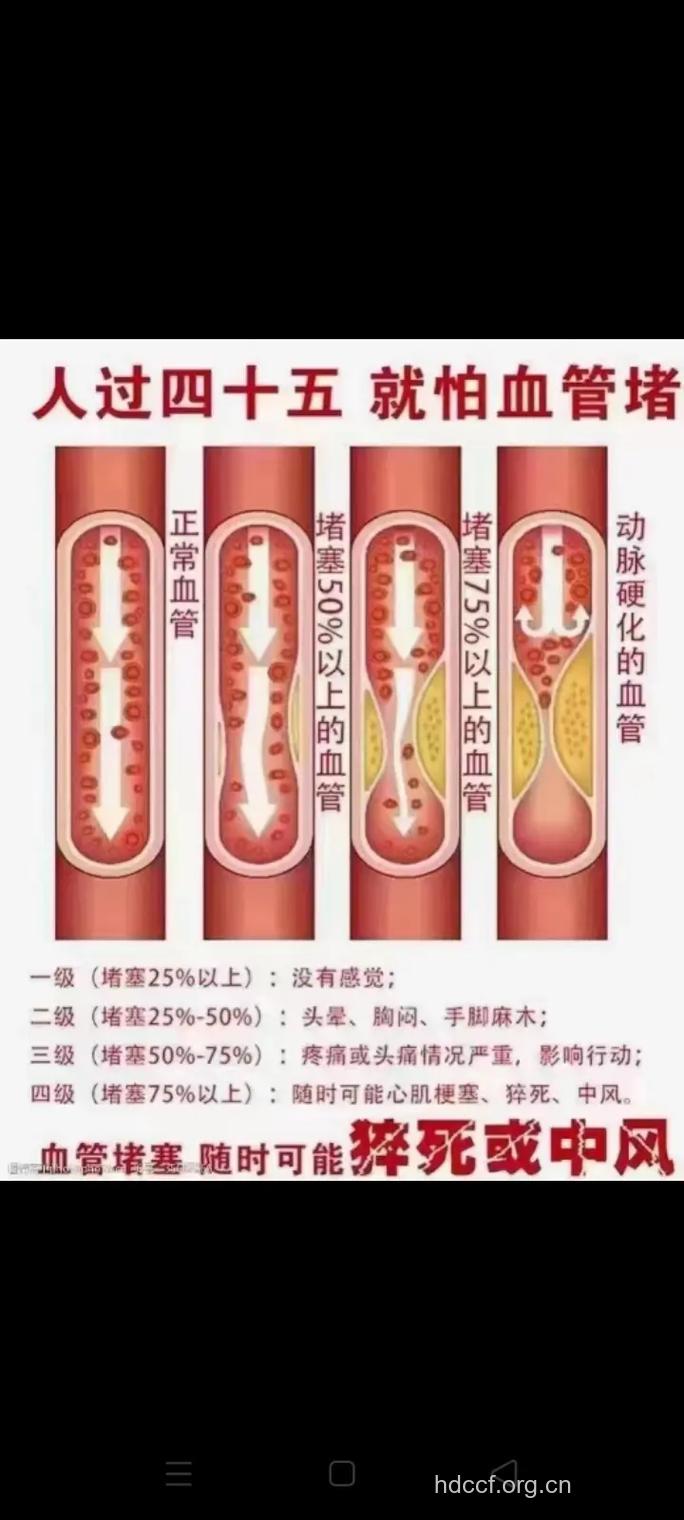 4种运动让中年人护住血管