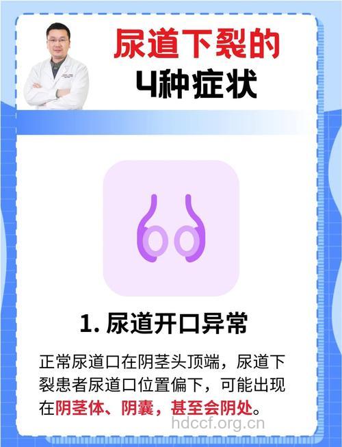尿道下裂的症状检查