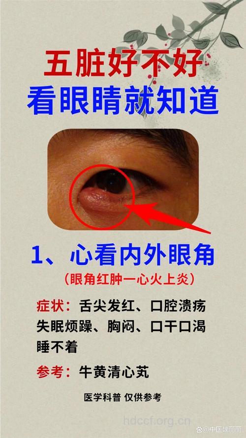 男性不育 请查查眼睛