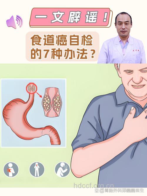 诊断食道肿瘤的方法有哪些