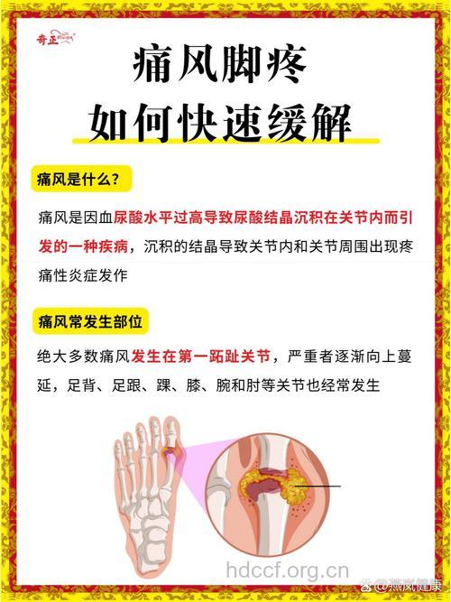 痛风发作疼痛难忍怎么办 支招快速缓解方法