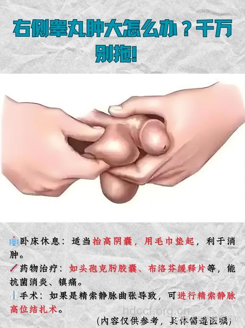 男性阴囊肿大有什么检查方法