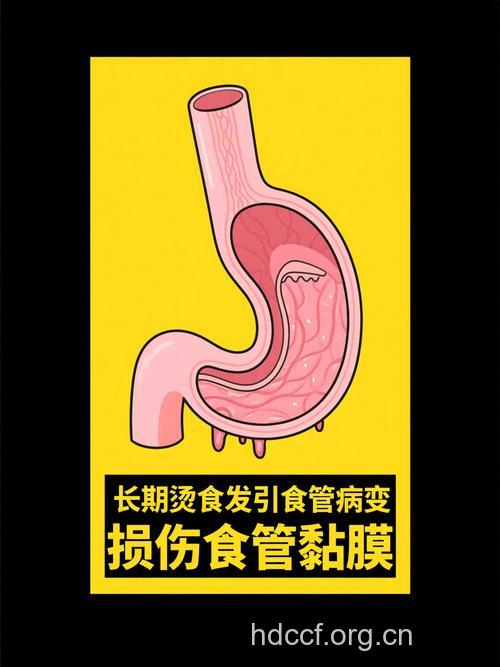 常吃火锅会引发食道癌风险