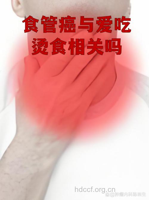 爱吃烫食容易诱发食管癌