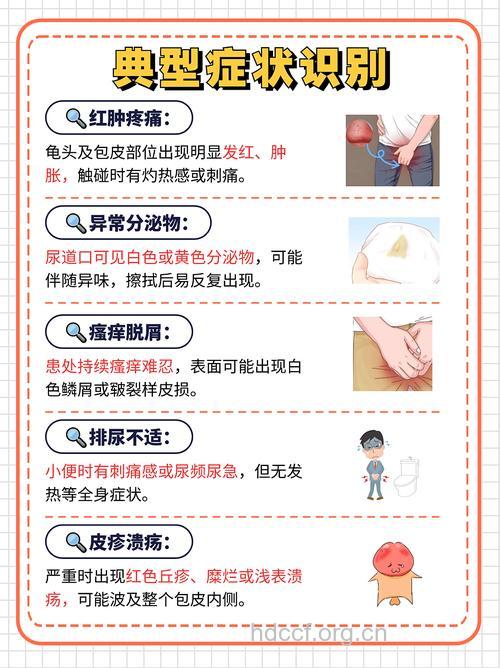 如何自诊包皮龟头炎