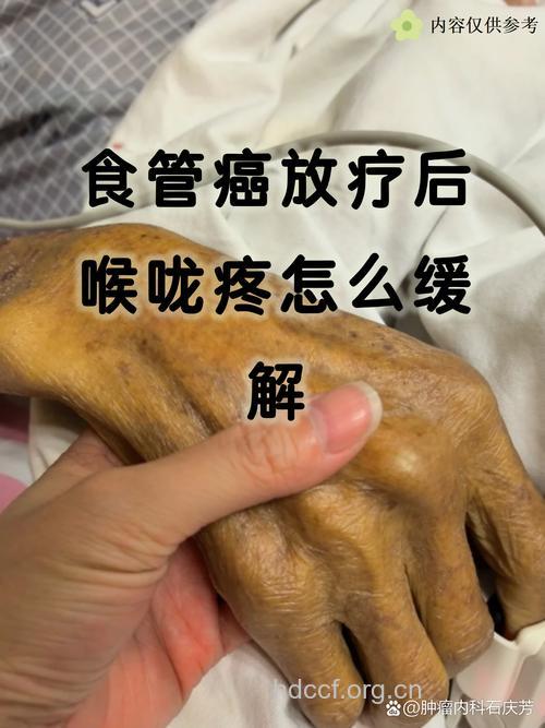 食道癌放化疗后的不良反应