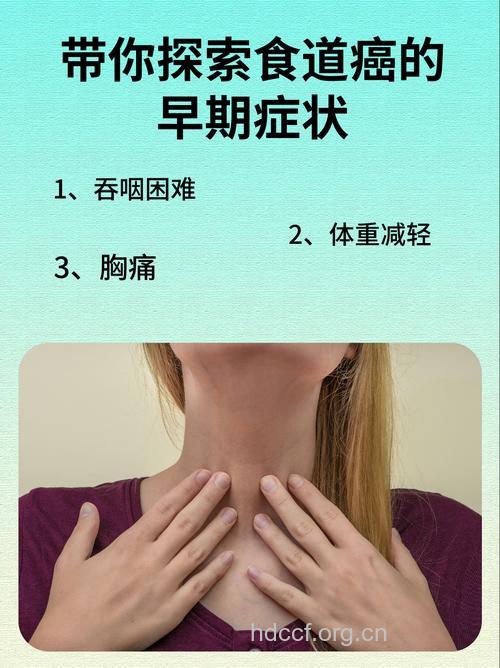 食道癌发病初期有什么表现呢
