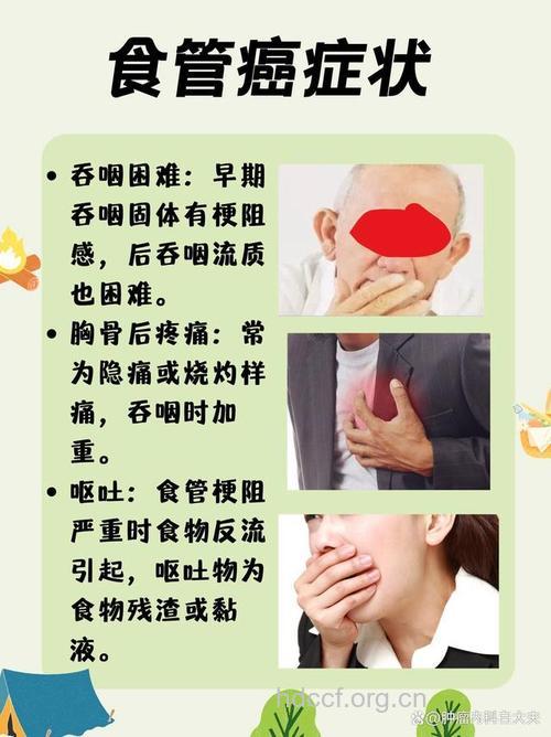 怎么识别中期食道癌的症状呢