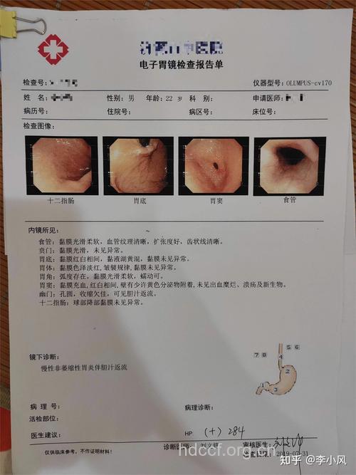 食道癌的晚期有哪些症状呢