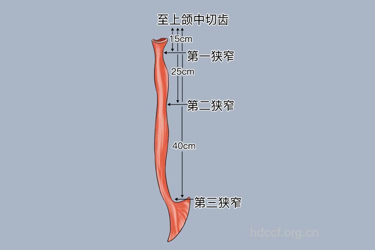食道癌好发部位是哪里呢