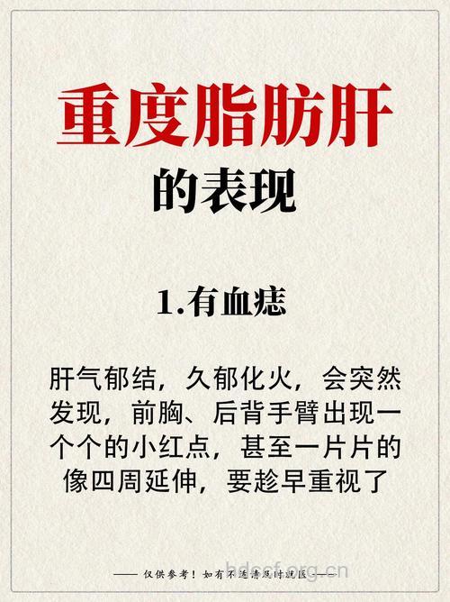 脂肪肝有哪些疾病征兆