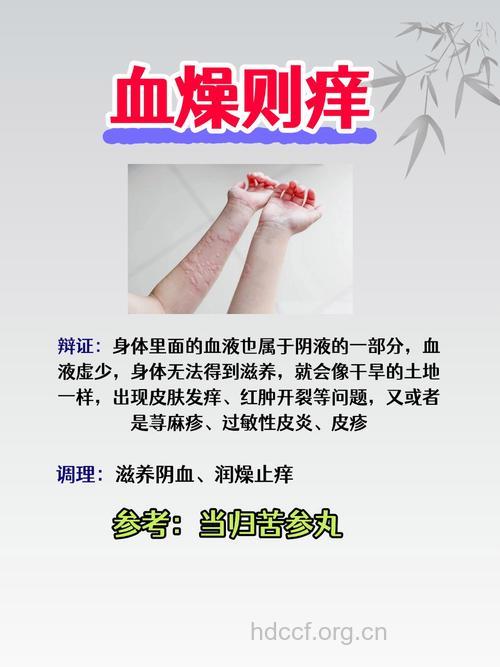 血热会引起皮肤病吗 血热型皮肤瘙痒的治疗