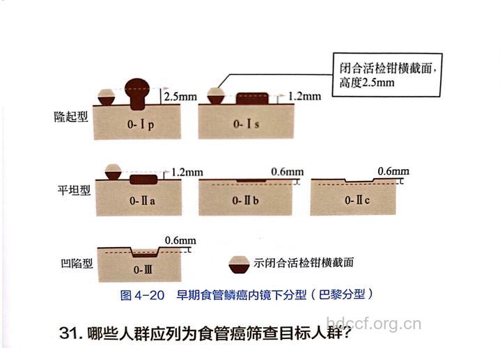 食管癌怎么辨证分型呢
