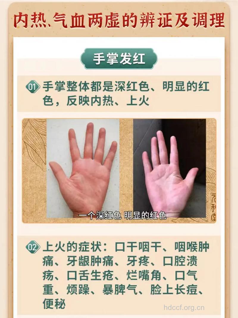 手部6个症状可能是疾病前兆
