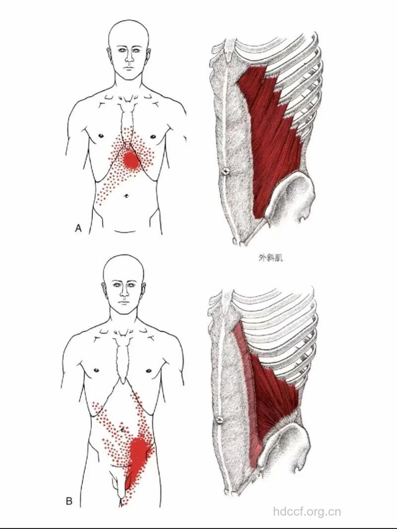 腹外斜肌在哪 你真的知道吗