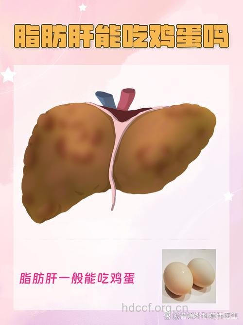 为什么吃单面煎蛋易诱发脂肪肝
