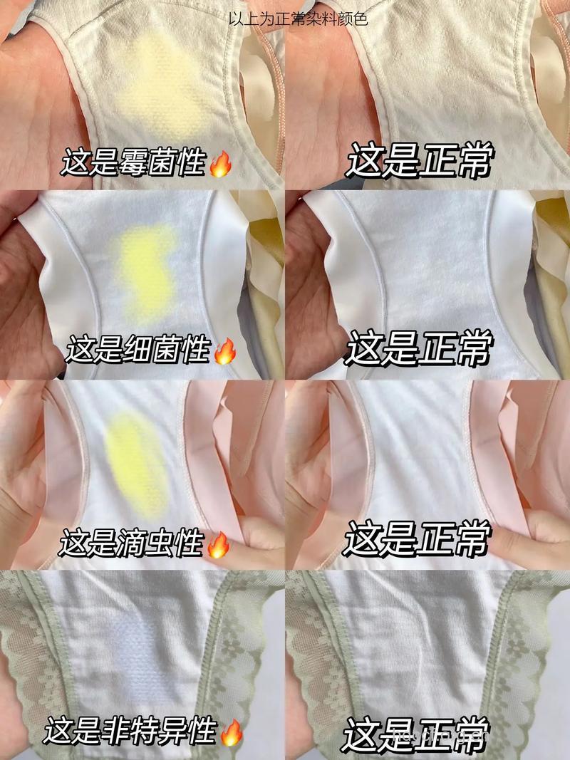 女性内裤隐藏的6种健康信号