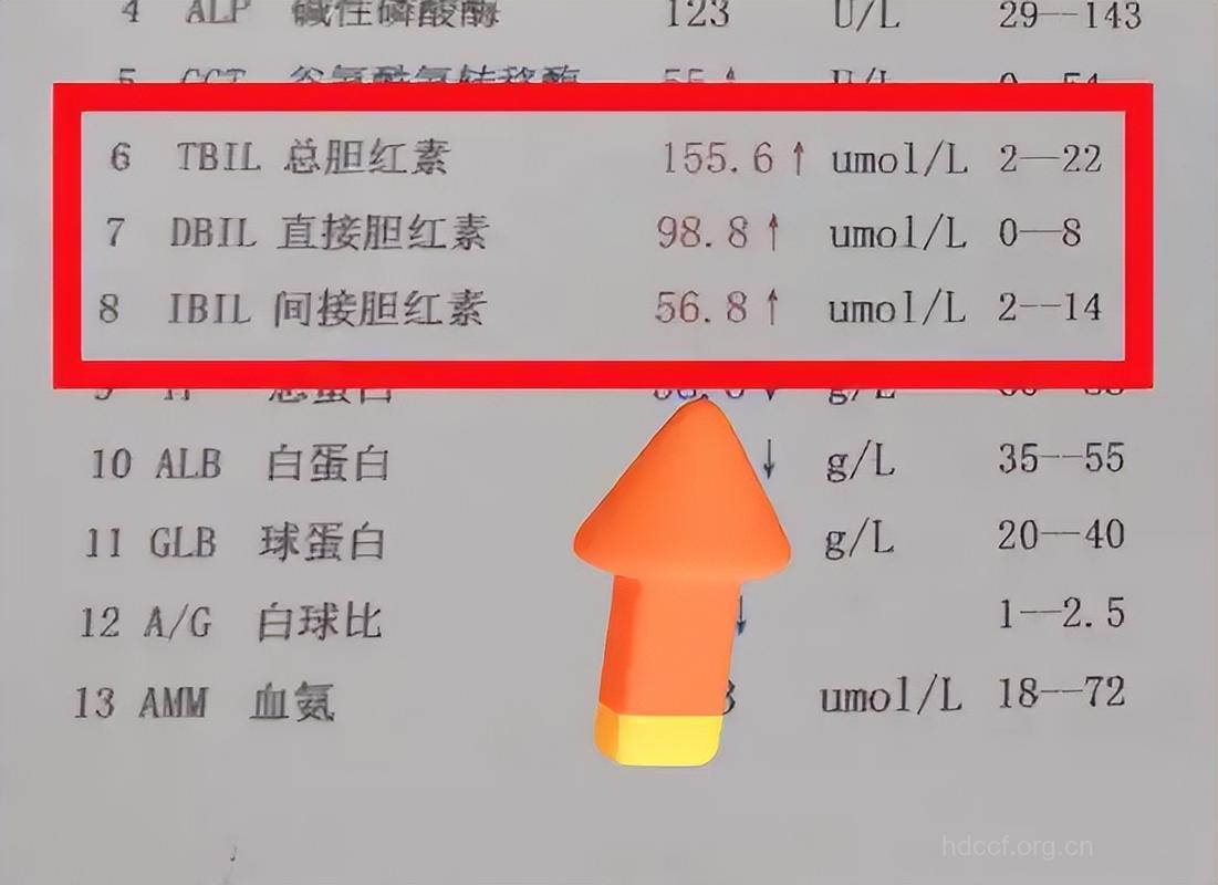 胆红素数值可辨别肝脏健康程度