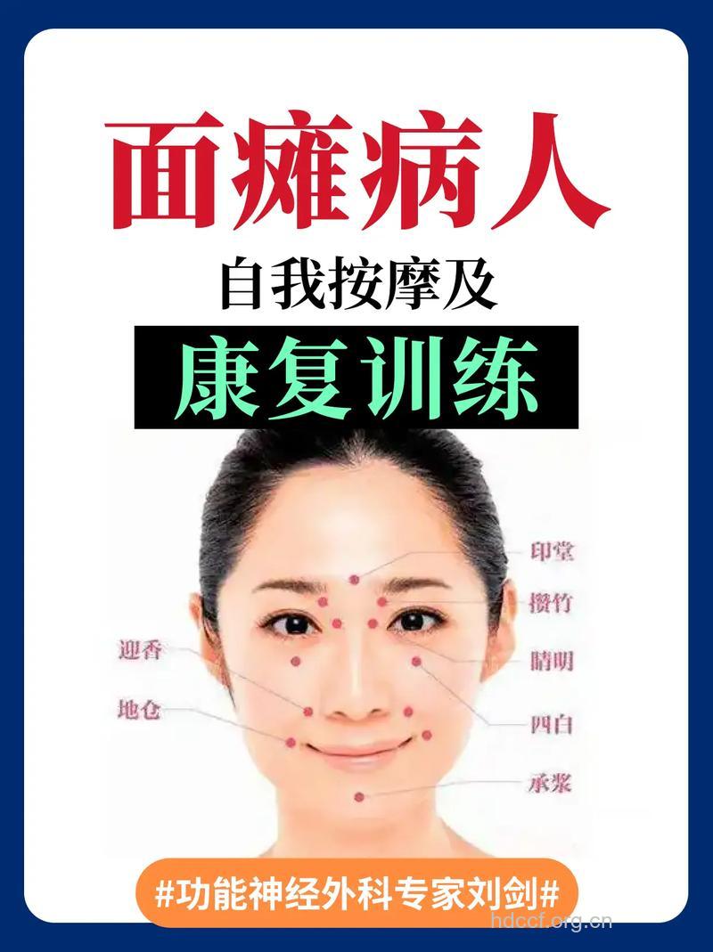 中医治疗面瘫的方法