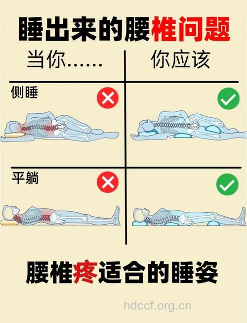 腰椎间盘突出症患者的睡姿要求