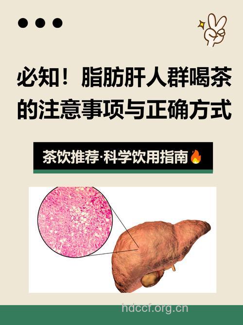 饭后喝茶小心脂肪肝