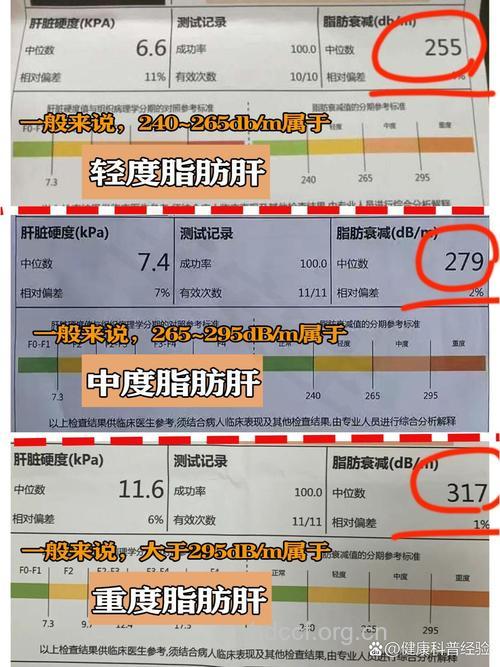 测测你的易得脂肪肝指数