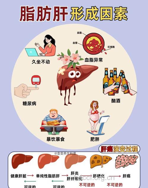 六因素成就脂肪肝