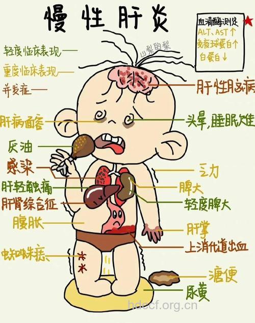 中医教你判断小儿是否得了肝炎