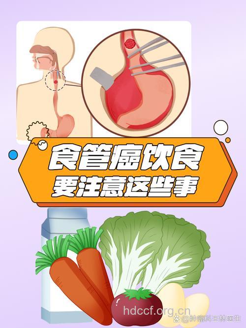 改善饮食习惯预防食道癌