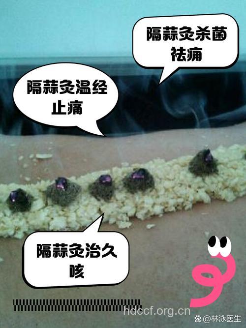 中医去狐臭偏方 隔蒜泥灸法