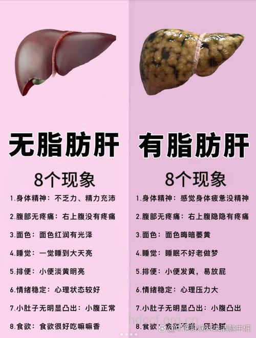 瘦人脂肪肝并非少见