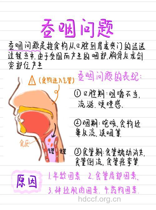 怎么缓解食道癌吞咽困难