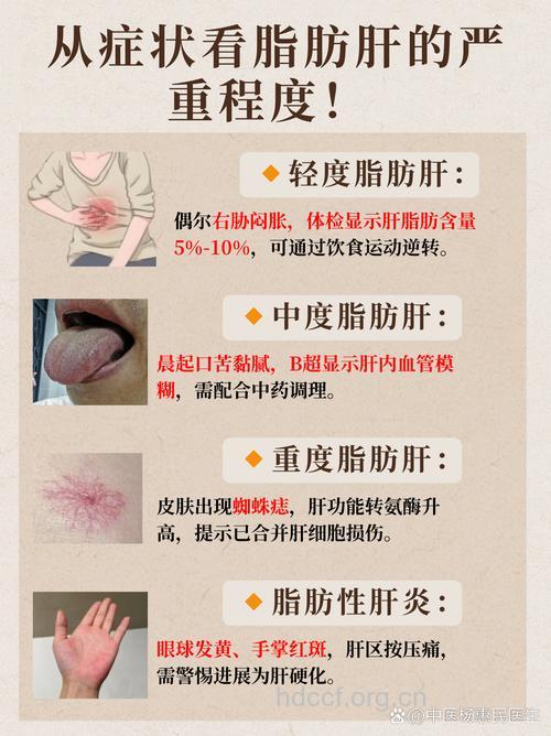 你身上有脂肪肝的信号吗?