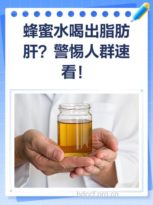 甜饮料喝出脂肪肝