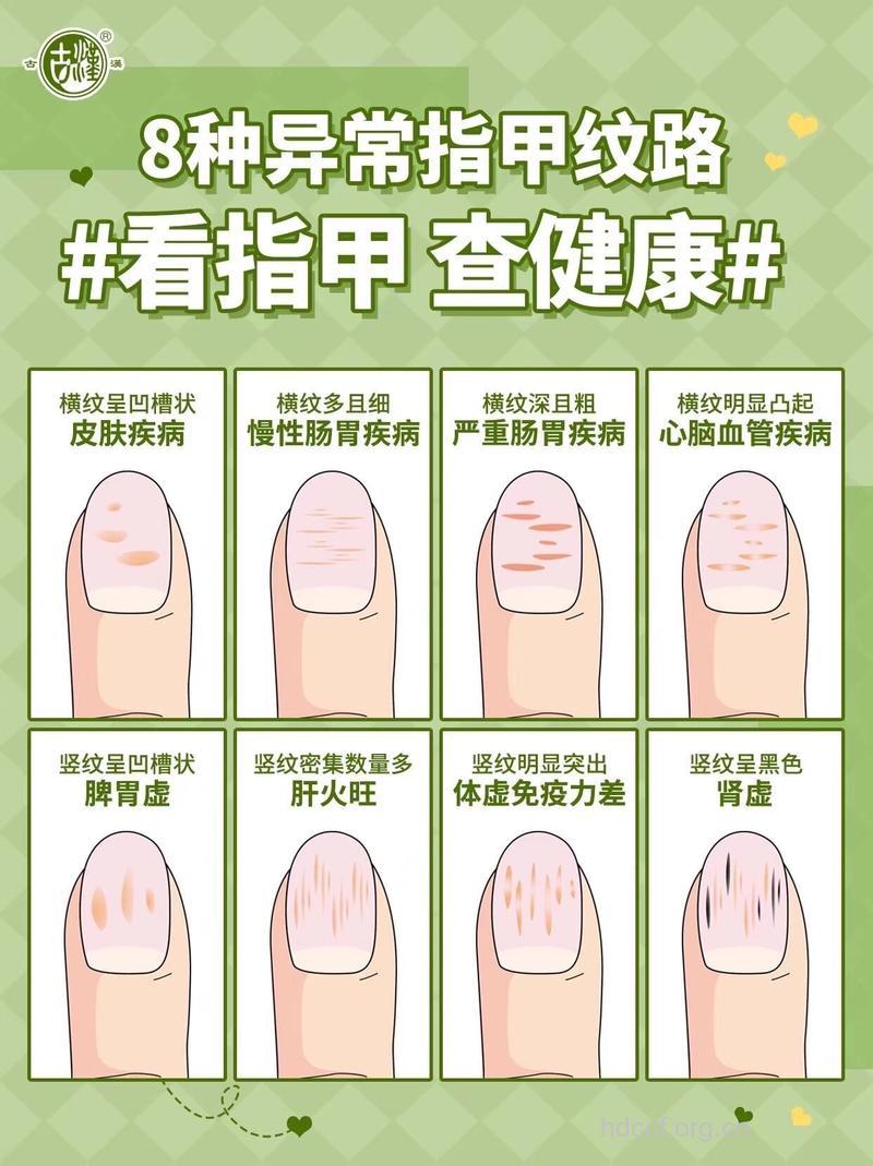女性长指甲更容易患妇科病