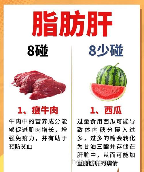 不得不看:脂肪肝治疗全攻略