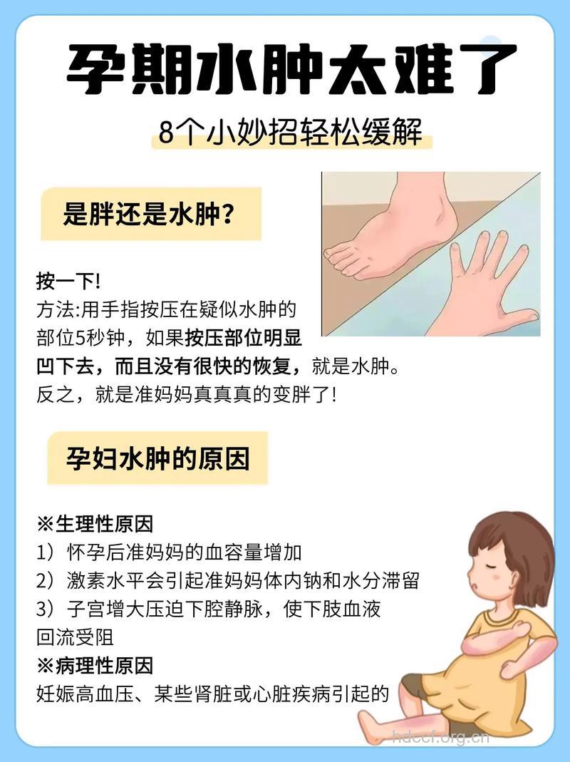 怎么解决妊娠水肿方法