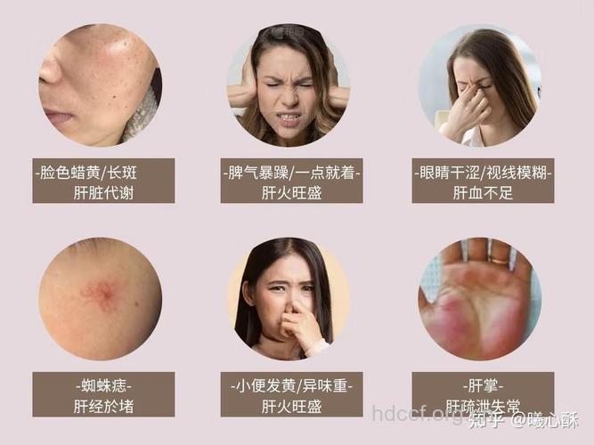 肝硬化患者皮肤容易变差的原因