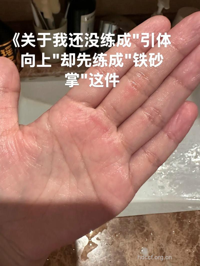 做引体向上手长茧怎么办 推荐三个妙招