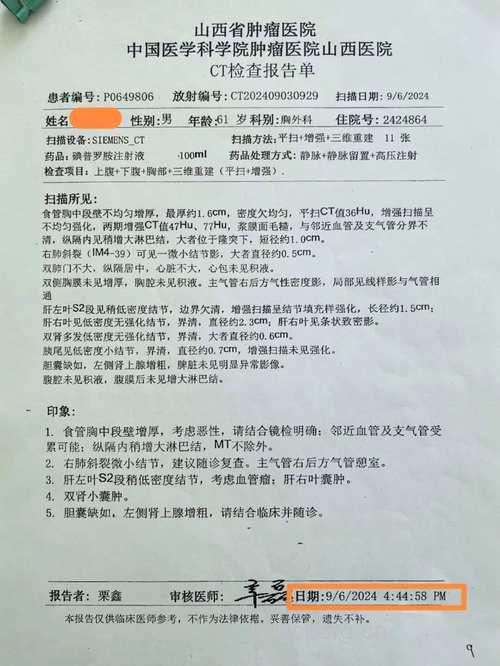 食管癌典型病例分析