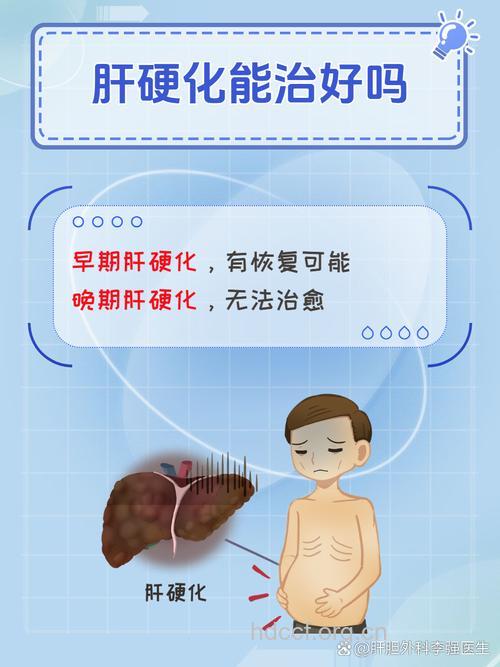肝硬化患者看到新的希望